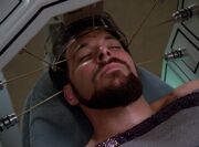Riker Stimulation der Nerven
